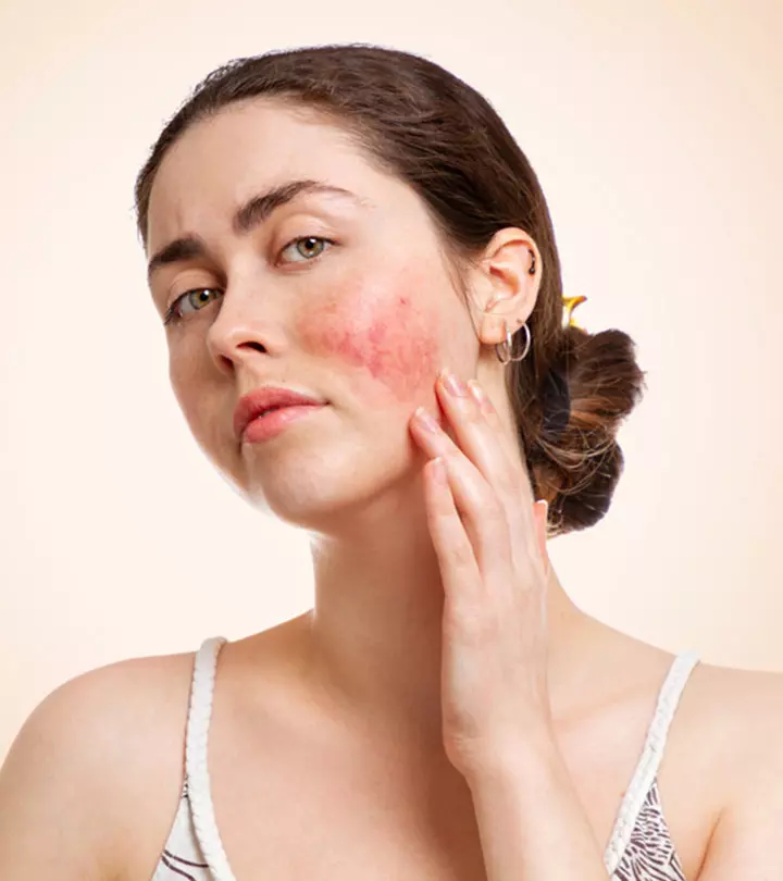 Skin inflammation: Causes, symptoms, diagnosis, and treatment